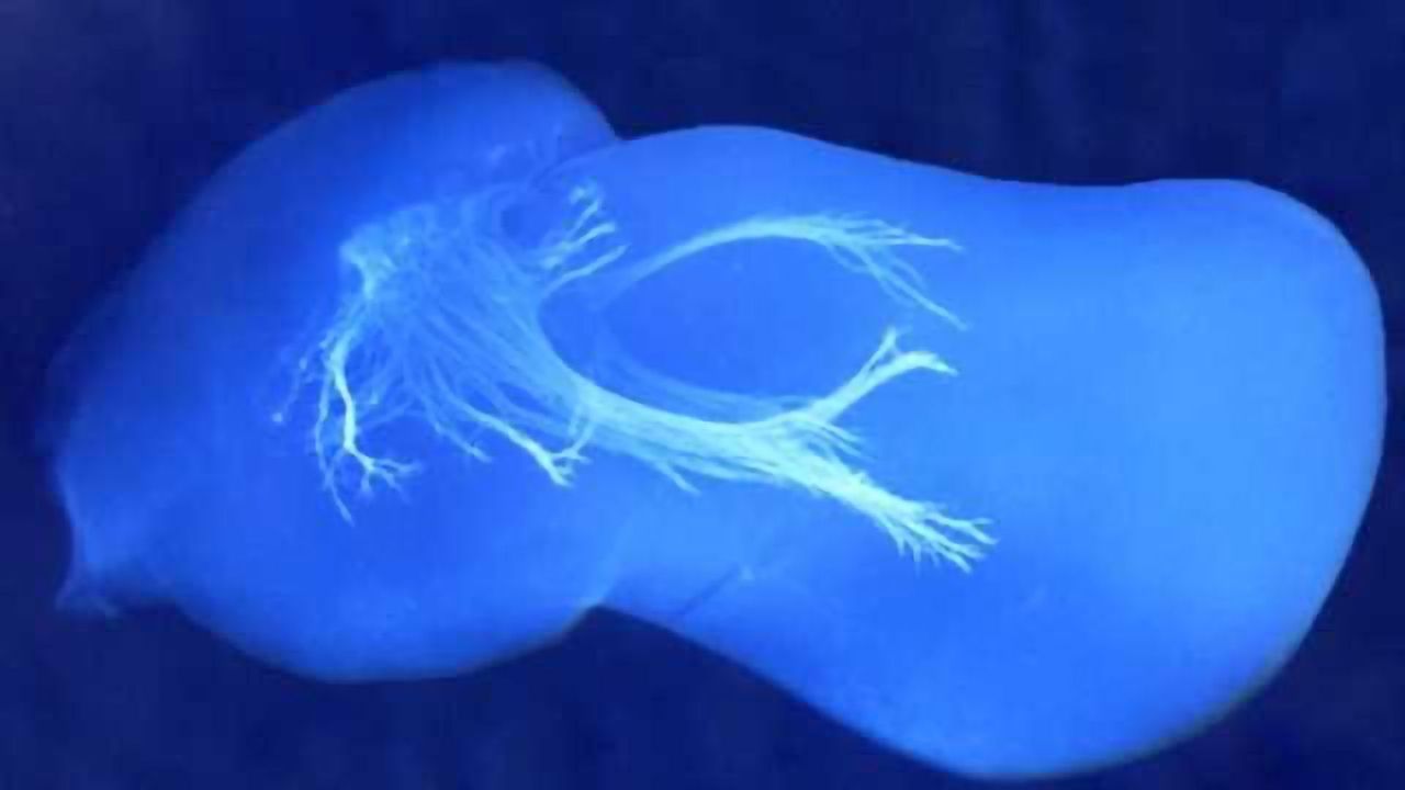 Embryonic Nerves