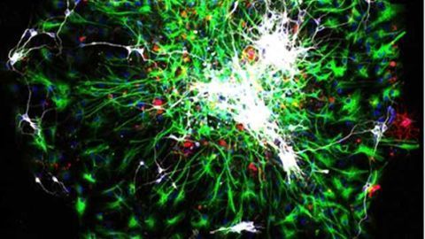 Postnatal neurogenesis