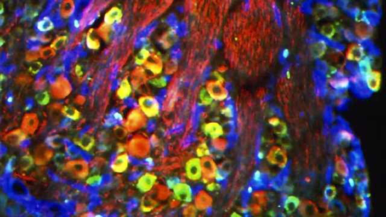 Pain and touch sensory fibers in DRG