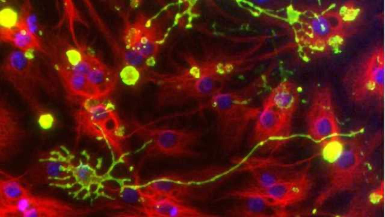 Neural stem cell culture