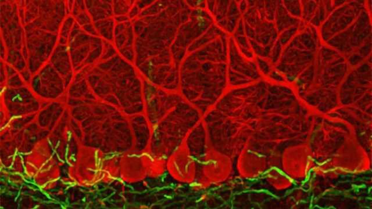 Purkinje cells in the cerebellum