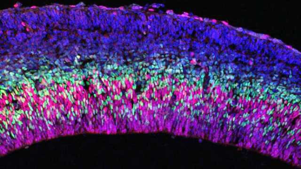 Neurobiology: Epigenetics and neural cell death