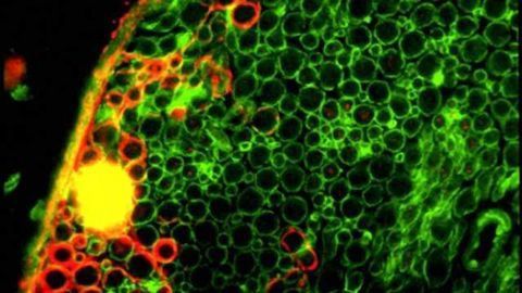 Neuroregeneration in a dish