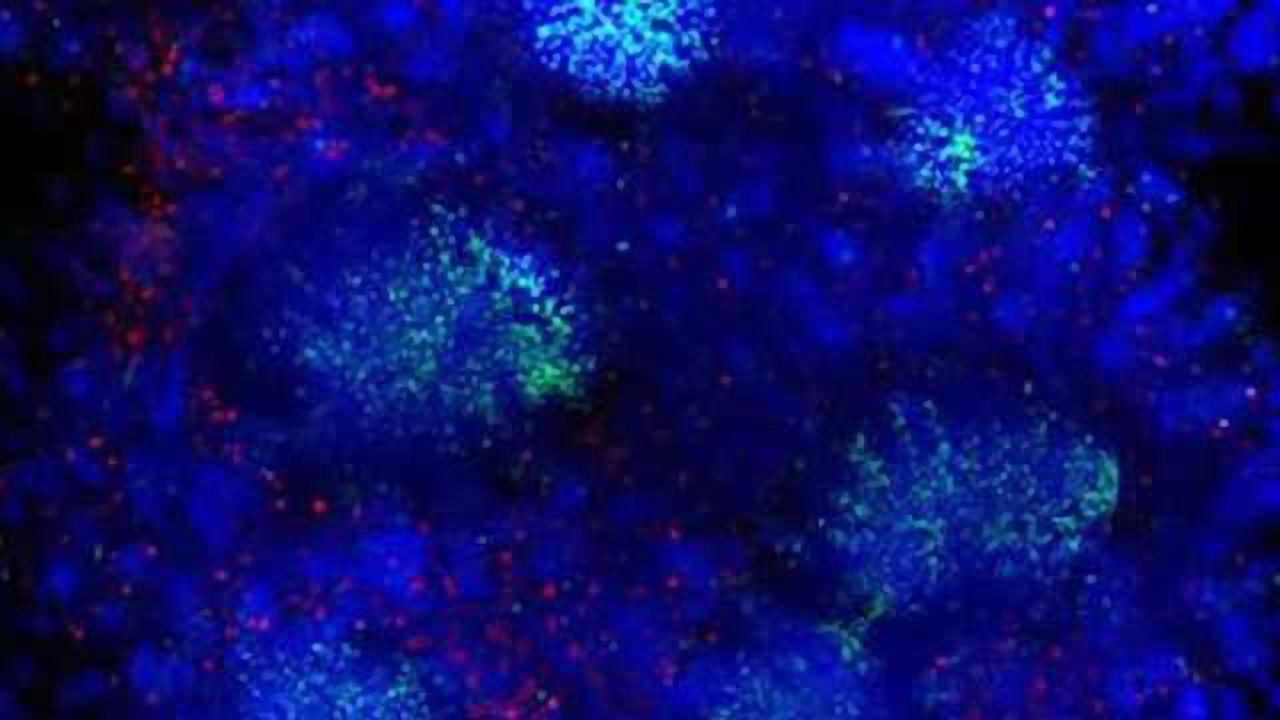 Prions in the gut