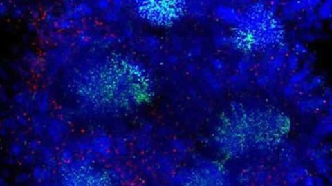 Prions in the gut