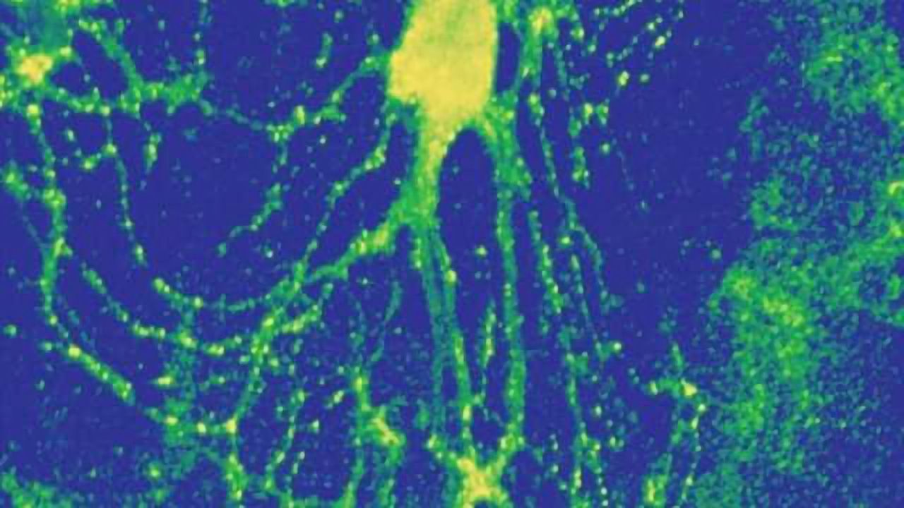 Hippocampal neurons