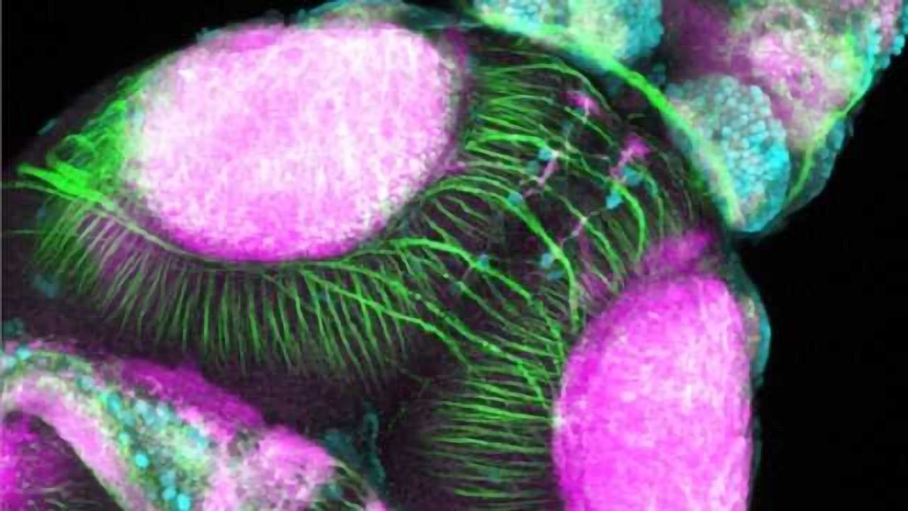 Zebrafish brain