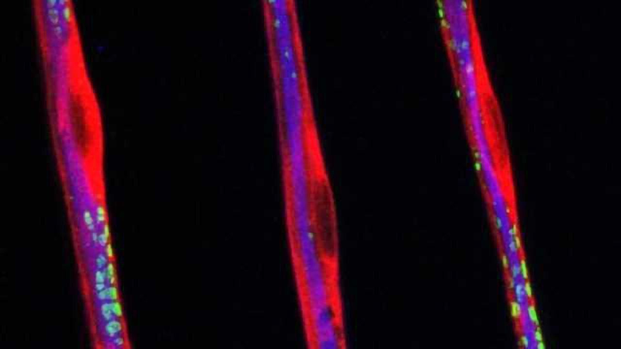 Sciatic nerve fibers