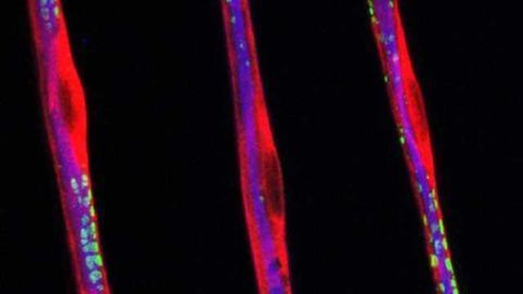 Sciatic nerve fibers