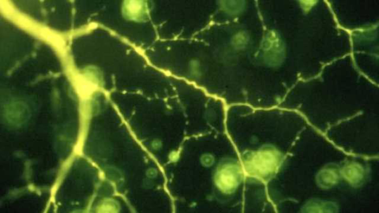 Alpha cell in ferret retina