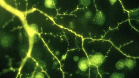 Alpha cell in ferret retina