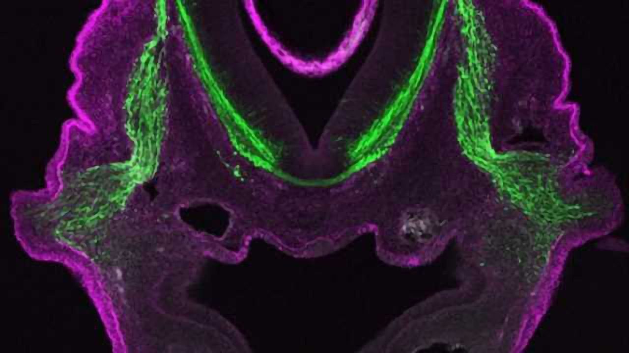 Laminin & cranial ganglion
