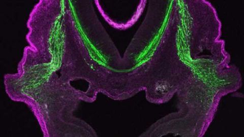 Laminin & cranial ganglion