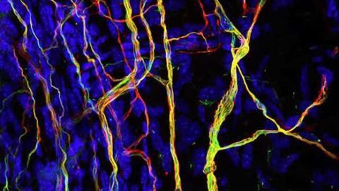 Sensory Neurons