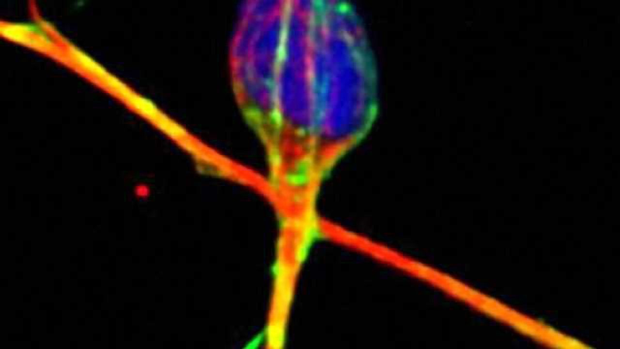 Cerebellar granule neuron