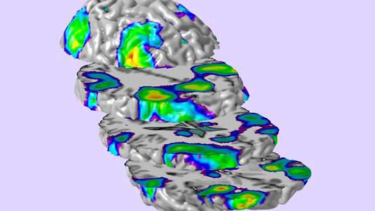 Prenatal alcohol exposure alters development of brain function