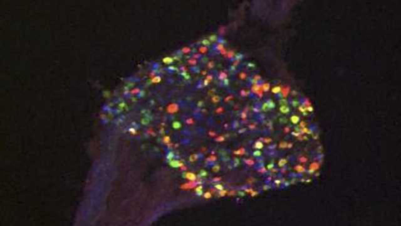 Dorsal root ganglion