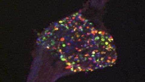 Dorsal root ganglion