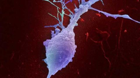 Retinal ganglion cell
