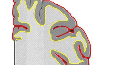 Reprogramming 'support cells' into neurons could repair injured adult brains