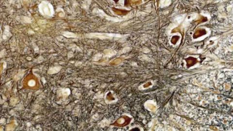 Rat spinal cord