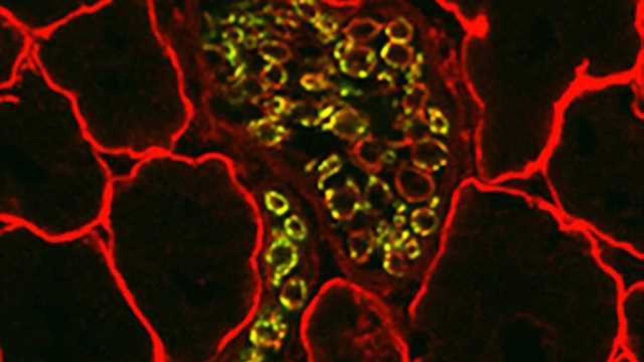 Skeletal muscle nerve