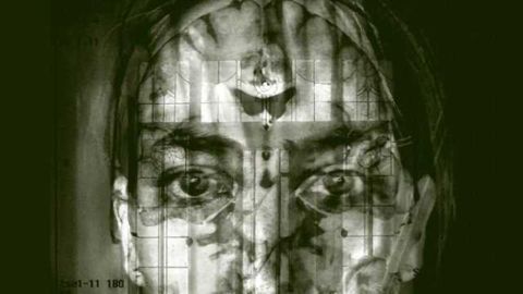 Study of self-awareness in multiple sclerosis has implications for rehabilitation