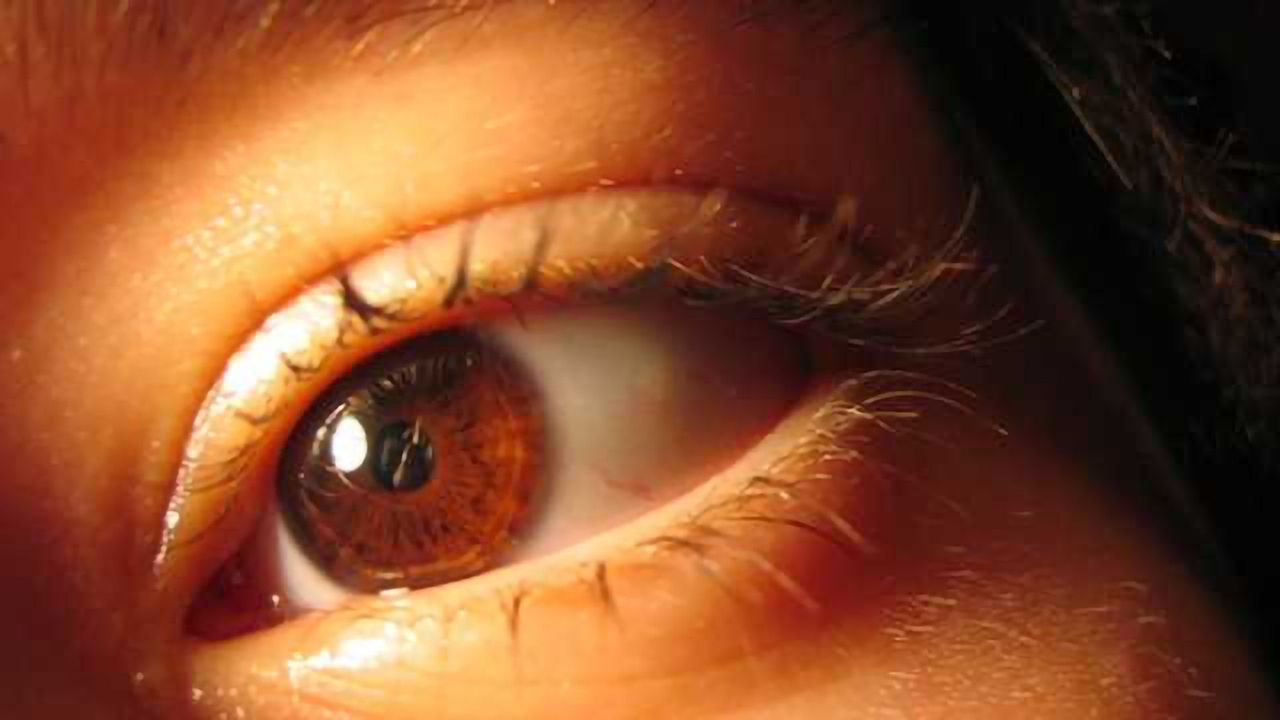 Retinal changes may serve as measures of brain pathology in schizophrenia