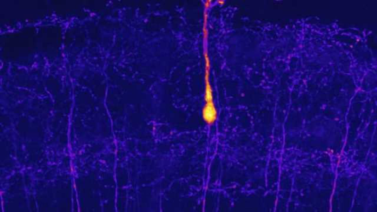 Zebrafish neurons