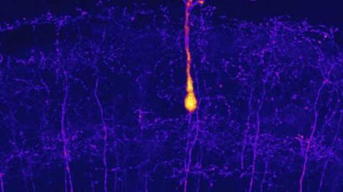 Zebrafish neurons