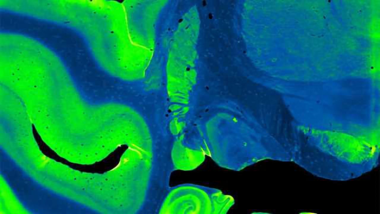Alpha-synuclein proteins