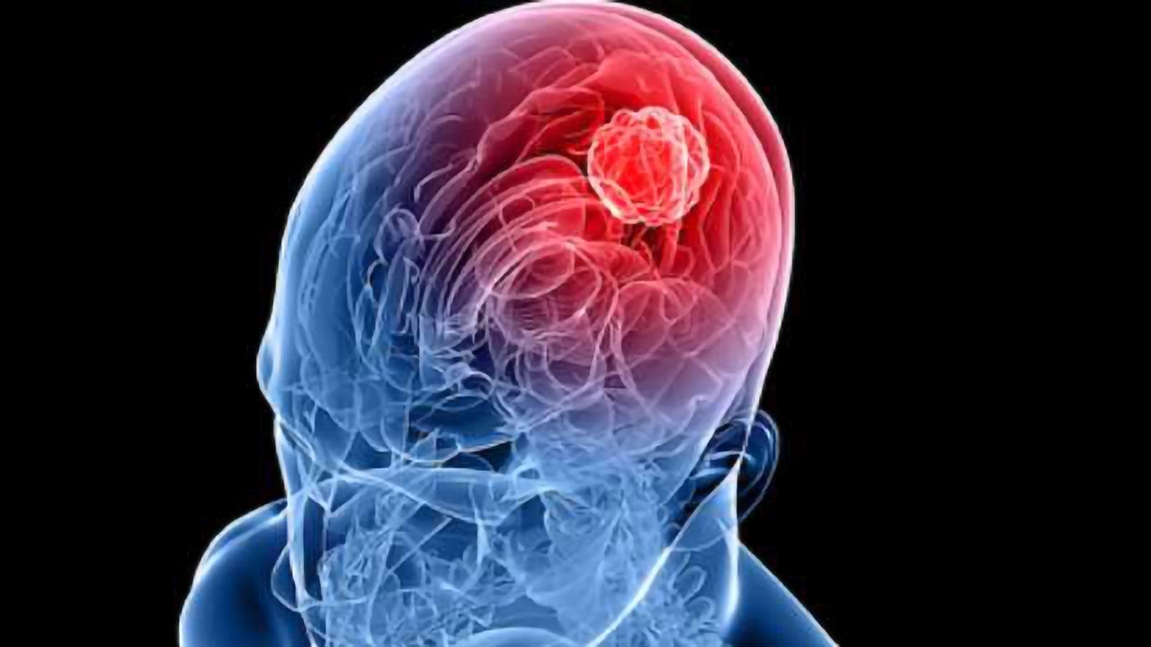 A One Two Punch for Brain Cancer