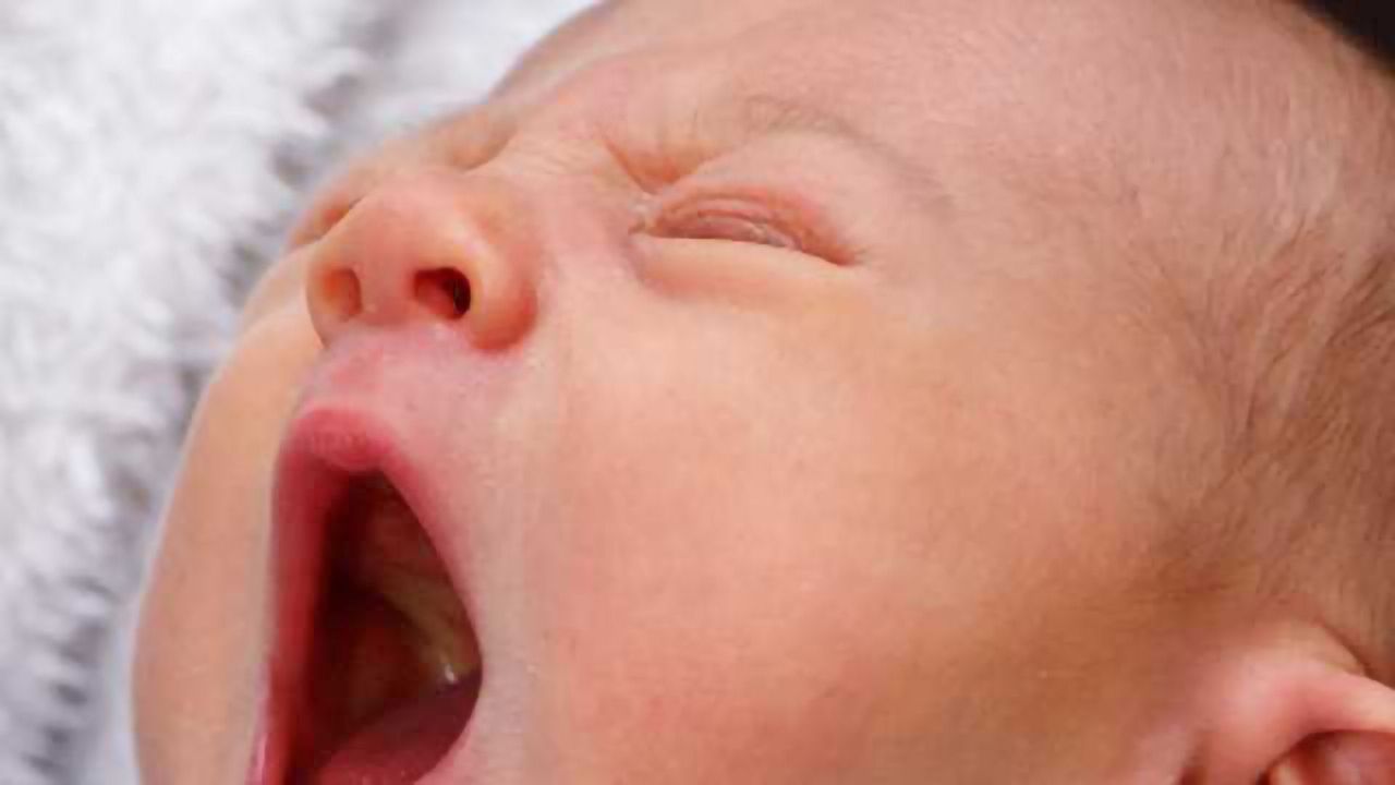 Excess Lipoproteins May Cause Chronic Kidney Stones in Children
