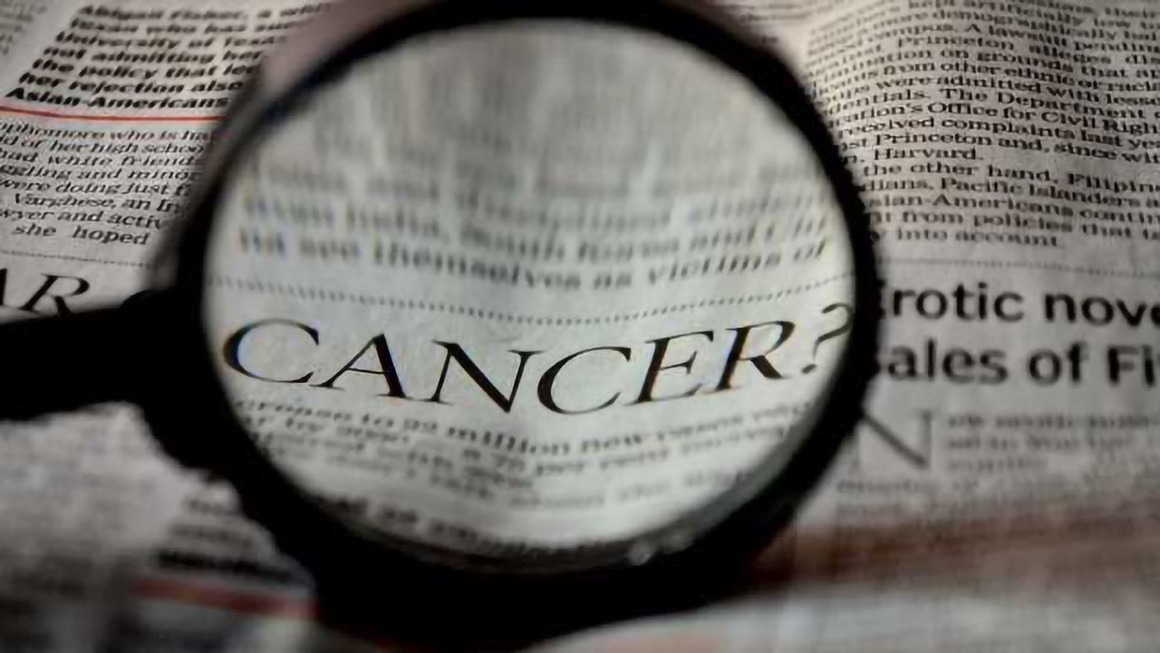 Dynamin1 Found to be in Aggressive Cancer Cells