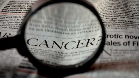 Dynamin1 Found to be in Aggressive Cancer Cells