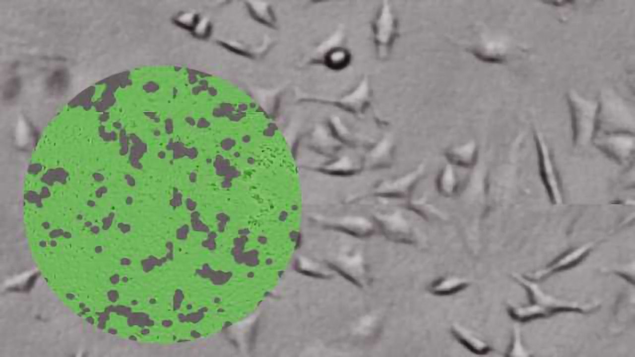 Cost-effective, Walkaway Automation of Live Cell Assays