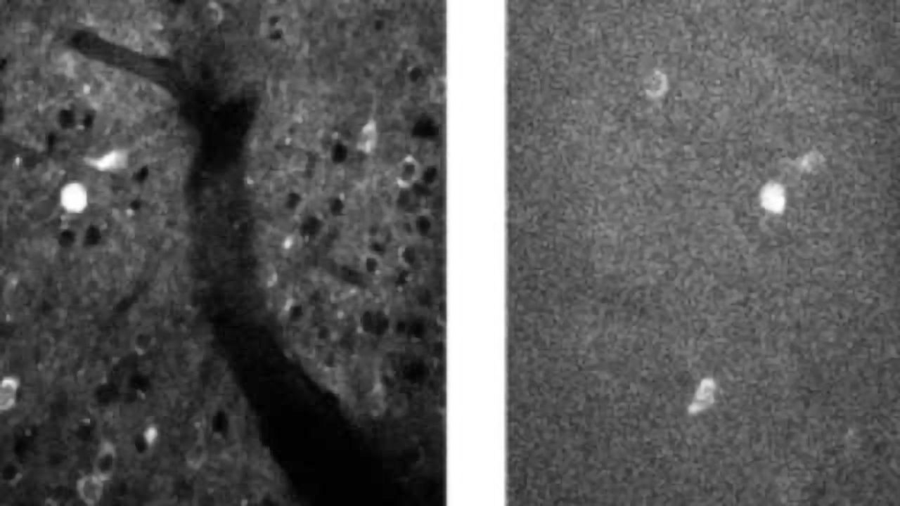 Non-Invasive Imaging of Mouse Brain Developed