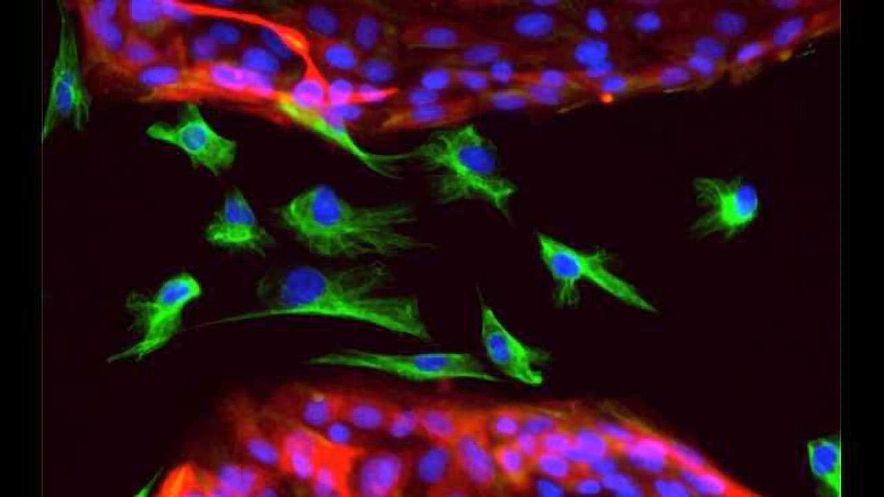 How Do Breast Cancer Stem Cells Resist Chemotherapy?