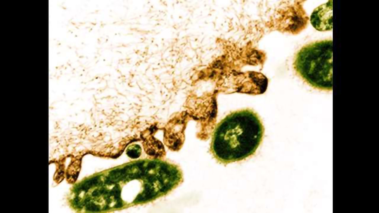 Two Conditions Combine to Cause Severe Infection