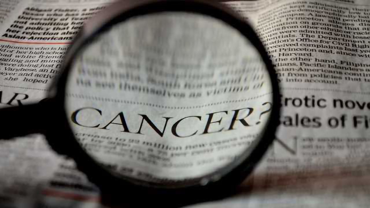 New LC-MS Method to Evaluate Salivary Proteins as Oral Cancer Biomarkers