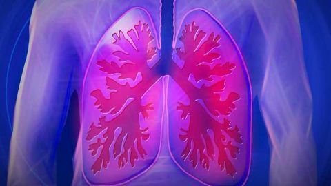 Towards Noninvasive Detection of Lung Cancer