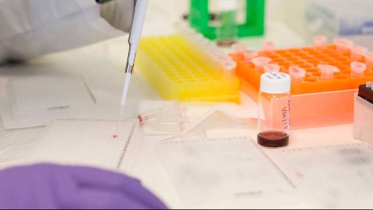 Catching Ebola in its Tracks