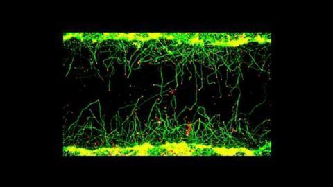 Fungal Molecule Could Hold key to Nerve Regrowth