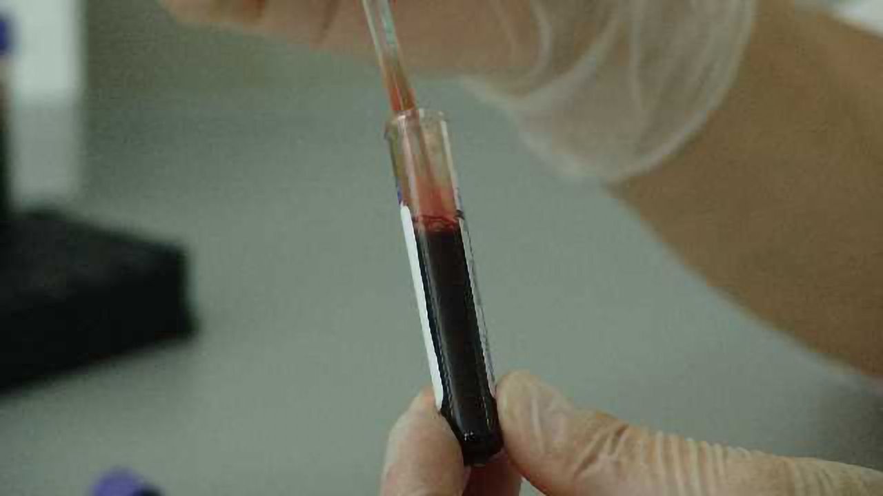 The Future of Pathology is Minimally Invasive