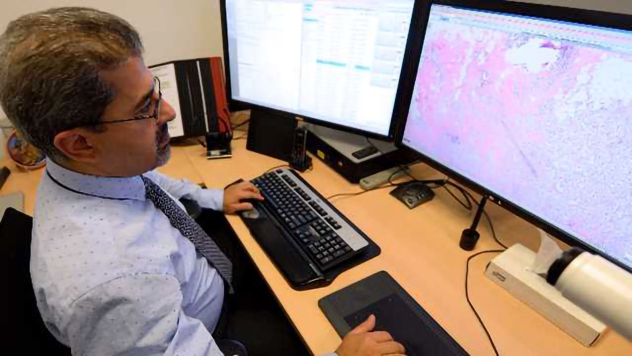 Philips, LabPON to Create Digital Pathology Database