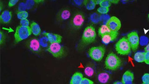Vitamin C Kills Cancer Stem Cells