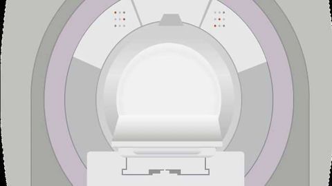 MRI Scan Spots HIV in the Brain