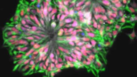 Stem Cell-based Modelling can be Difficult for Rare Genetic Variants