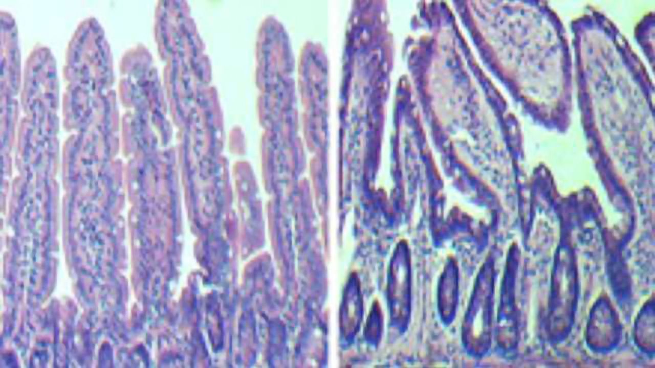 Reversing Aging of Intestinal Stem Cells