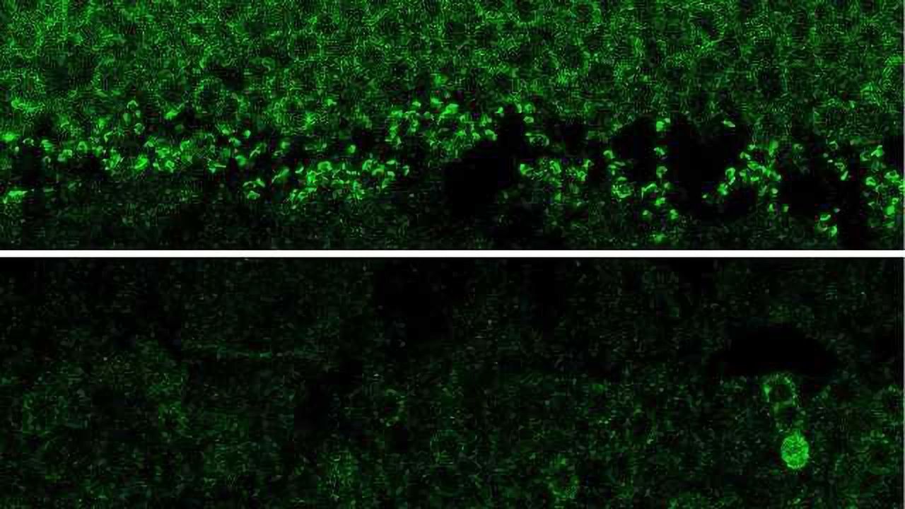 Preventing Loss of Vision with CRISPR